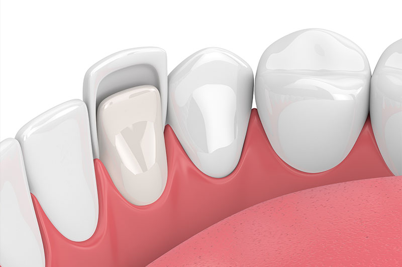 Dentist in Fort Wayne