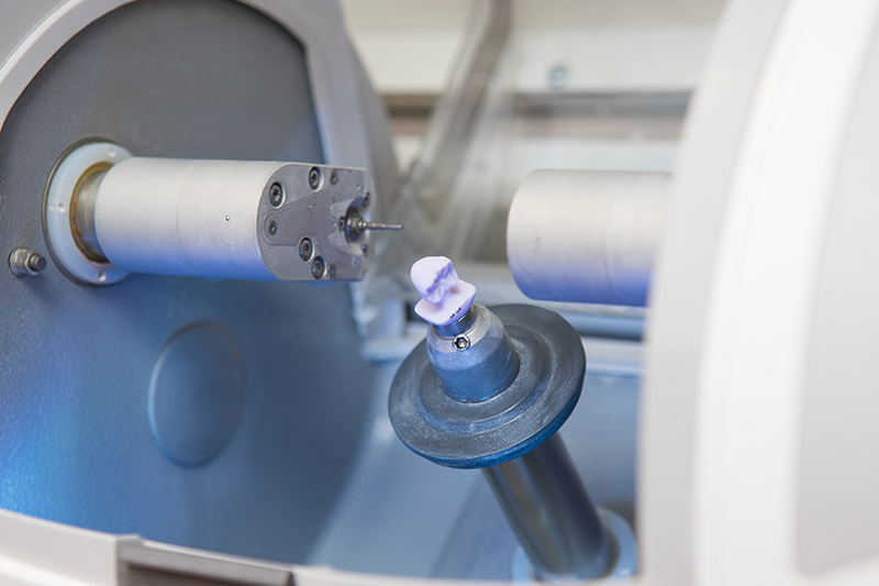 Same Day Crowns in Fort Wayne